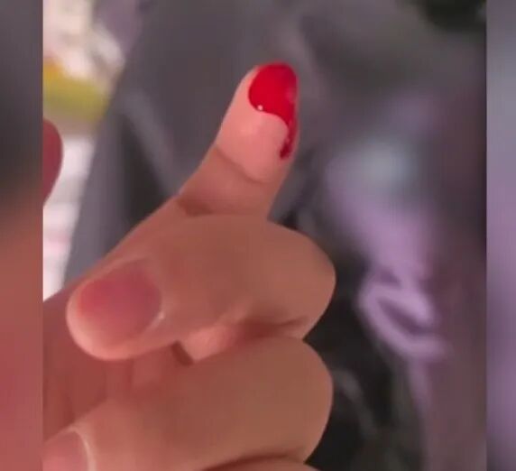 网购衣服藏针扎伤孩子?女子一年半索赔9起,不赔钱就曝光!警方:刑拘 网购衣服藏针扎伤孩子?女子一年半索赔9起,不赔钱就曝光!警方:刑拘