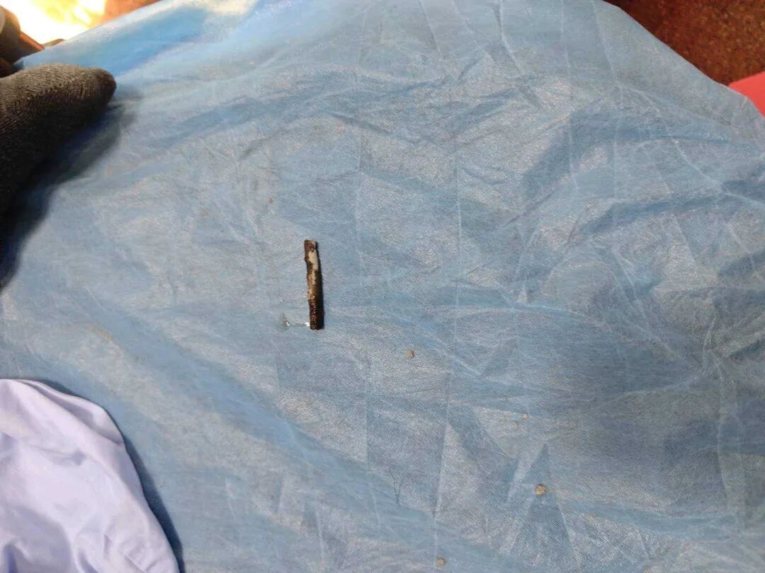 危险!工人背部被20厘米钢筋刺穿!深圳消防部门5分钟紧急切割 危险!工人背部被20厘米钢筋刺穿!深圳消防部门5分钟紧急切割
