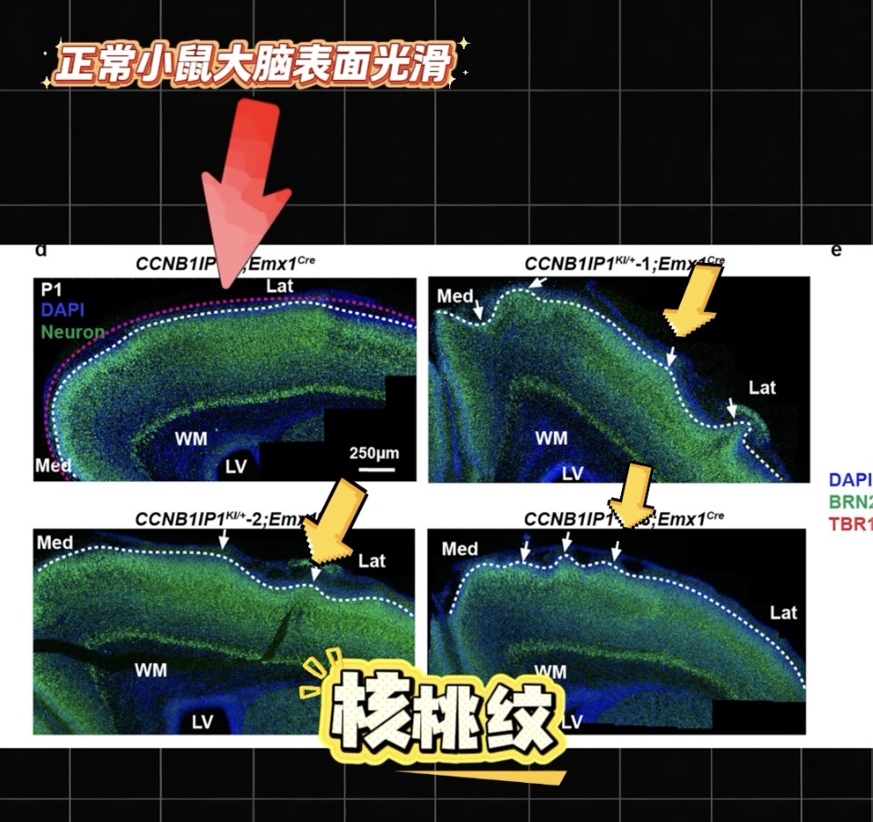 小鼠长出人脑褶皱!中国科学家找到人类超高智力关键基因 小鼠长出人脑褶皱!中国科学家找到人类超高智力关键基因