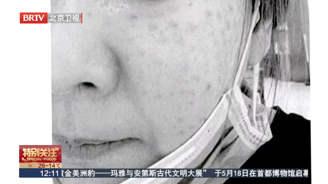 医师私设“家庭医美”，致女子十级伤残！北京朝阳法院判了——