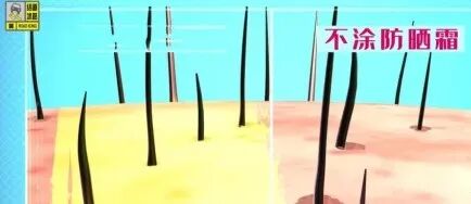 这个地方长痣，或比脚底更可能癌变！太多人从没留意过…