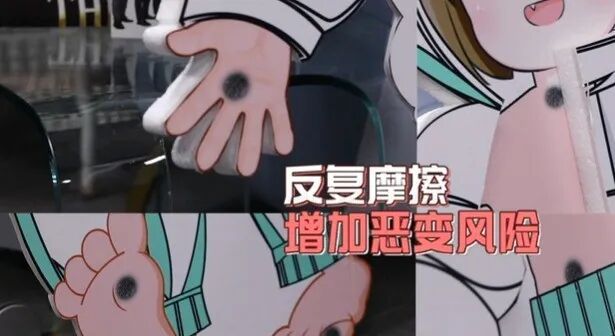这个地方长痣，或比脚底更可能癌变！太多人从没留意过…