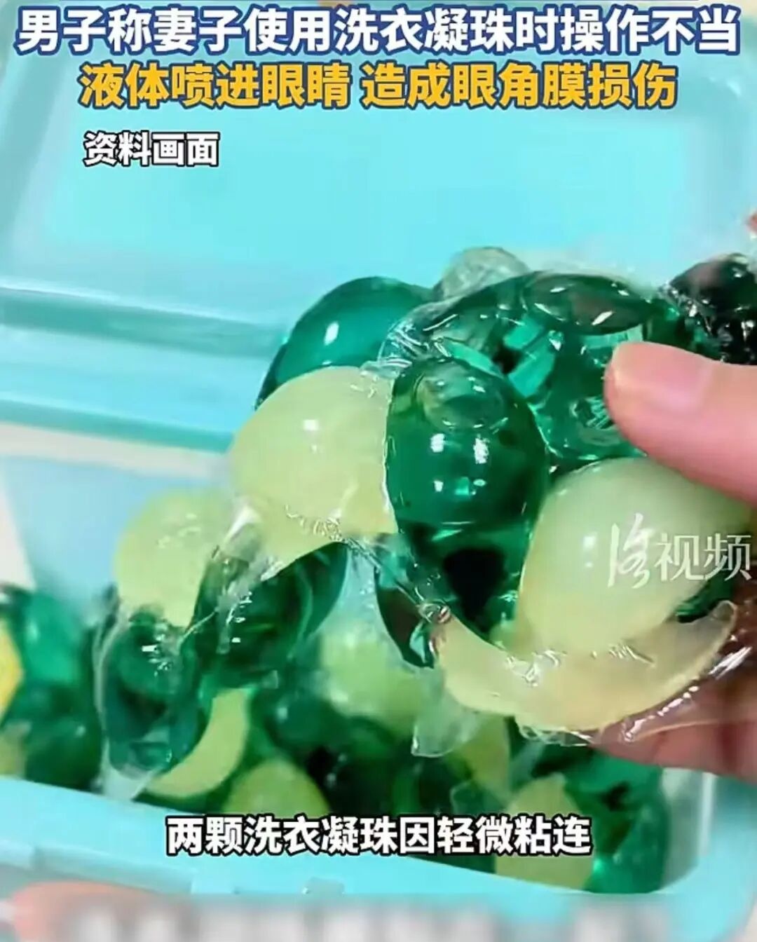洗衣凝珠突然爆开,女子眼角膜受损!网友:后怕...... 洗衣凝珠突然爆开,女子眼角膜受损!网友:后怕......