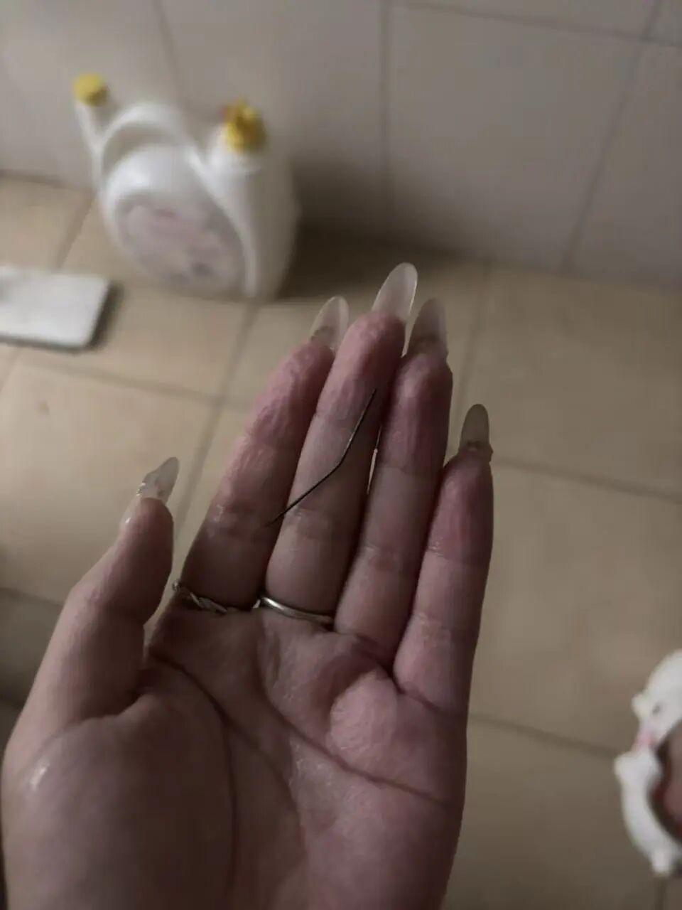 浙江一女子左臀疼了一个月,洗澡时挤出一根已发黑的注射针头,尚无法得知针头来源 浙江一女子左臀疼了一个月,洗澡时挤出一根已发黑的注射针头,尚无法得知针头来源