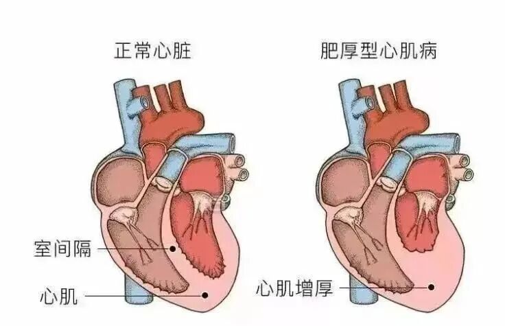 从今天起!这个睡觉习惯改一下!护心降血糖→ 从今天起!这个睡觉习惯改一下!护心降血糖→