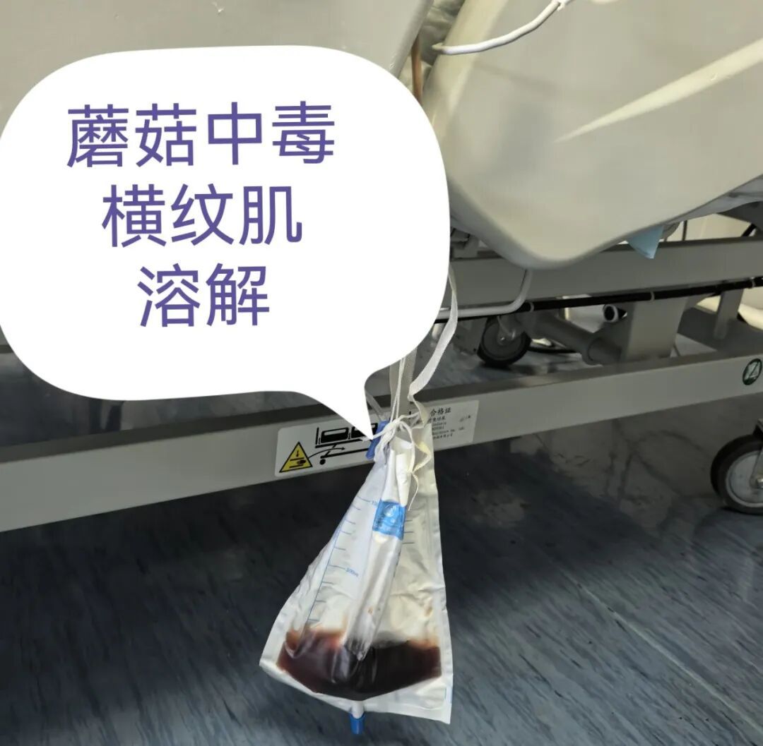 一盘“山珍”下肚,杭州男子直接进了ICU!近期大量出现,不要摘!不要吃! 一盘“山珍”下肚,杭州男子直接进了ICU!近期大量出现,不要摘!不要吃!
