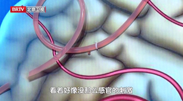 20秒测出你的大脑好不好,一套“手指操”,让手脑越练越灵活、记性好,反应更快 20秒测出你的大脑好不好,一套“手指操”,让手脑越练越灵活、记性好,反应更快