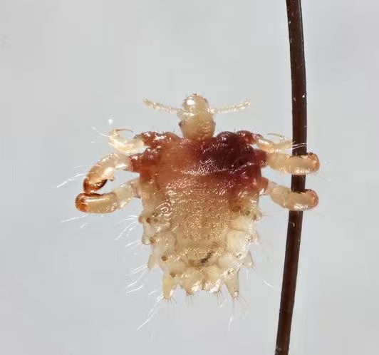4岁男童眼睛痒，家长以为只是结膜炎，检查发现睫毛有数十只小虫，医生提醒→