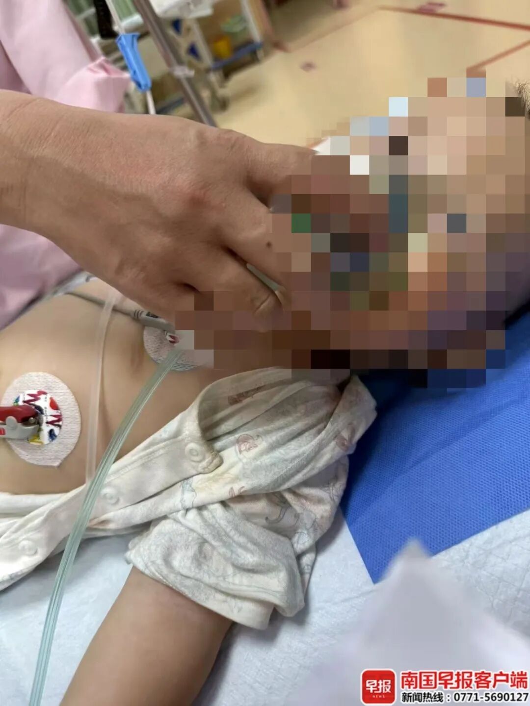 蛋壳上有针孔！1岁男童误食毒鸡蛋进ICU，邻居被逮捕