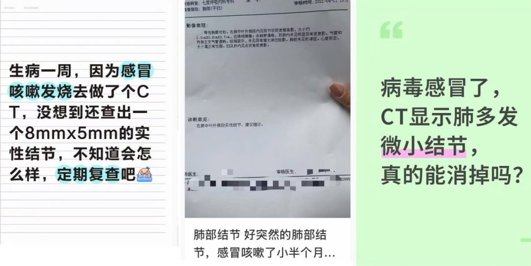 秋冬高发!流感、感冒后查出肺结节,会癌变吗? 秋冬高发!流感、感冒后查出肺结节,会癌变吗?