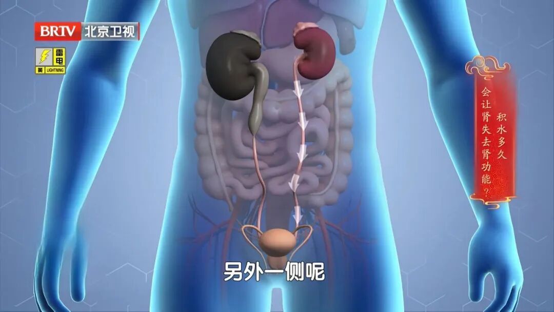 很多人都有的1个习惯,让肾结出一颗颗石头,多吃这几种食物,帮助身体顺畅代谢 很多人都有的1个习惯,让肾结出一颗颗石头,多吃这几种食物,帮助身体顺畅代谢