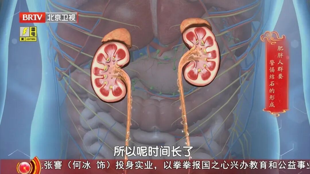 很多人都有的1个习惯,让肾结出一颗颗石头,多吃这几种食物,帮助身体顺畅代谢 很多人都有的1个习惯,让肾结出一颗颗石头,多吃这几种食物,帮助身体顺畅代谢