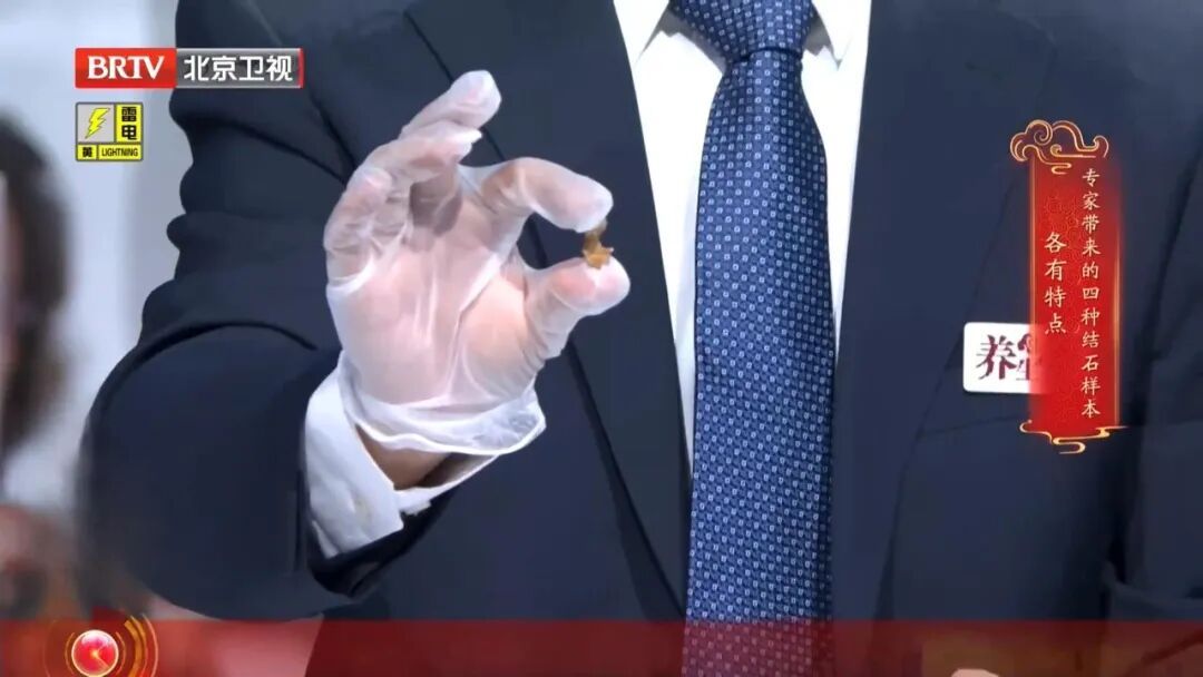 很多人都有的1个习惯,让肾结出一颗颗石头,多吃这几种食物,帮助身体顺畅代谢 很多人都有的1个习惯,让肾结出一颗颗石头,多吃这几种食物,帮助身体顺畅代谢