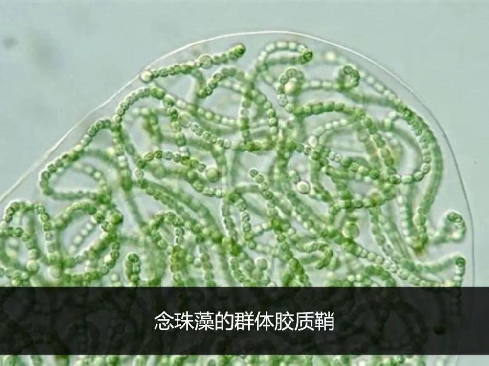 这种酷似头发的野菜是国家一级保护植物 这种酷似头发的野菜是国家一级保护植物