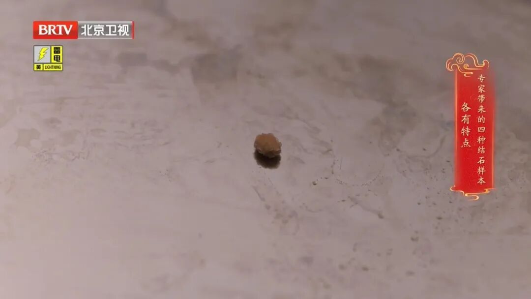 很多人都有的1个习惯,让肾结出一颗颗石头,多吃这几种食物,帮助身体顺畅代谢 很多人都有的1个习惯,让肾结出一颗颗石头,多吃这几种食物,帮助身体顺畅代谢