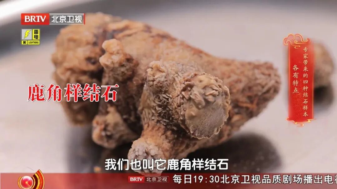很多人都有的1个习惯,让肾结出一颗颗石头,多吃这几种食物,帮助身体顺畅代谢 很多人都有的1个习惯,让肾结出一颗颗石头,多吃这几种食物,帮助身体顺畅代谢