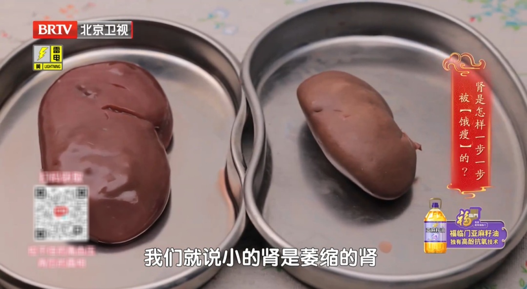 睡觉有这个表现,警惕肾病风险!医生提示:出现3种情况,立即就医 睡觉有这个表现,警惕肾病风险!医生提示:出现3种情况,立即就医