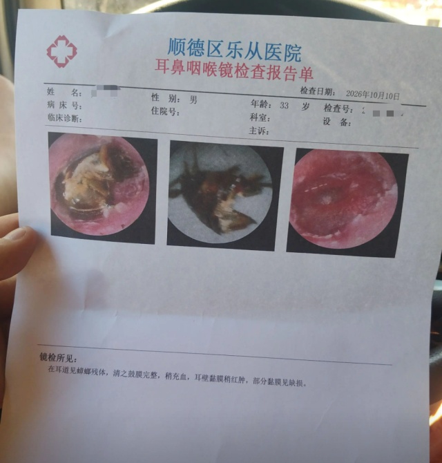 一男子睡梦中遭蟑螂钻耳道，蟑螂死在耳朵里后近一周才就医……医生：耳膜险些穿孔
