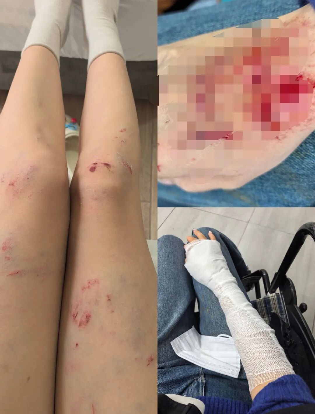后怕！玩滑翔伞起飞失败，中国游客从土耳其1200米的悬崖滚了下去，所幸挂在树上得救