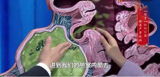 给肠道“减压”的食物，医生建议要多吃，排便又快又干净，还能防便秘
