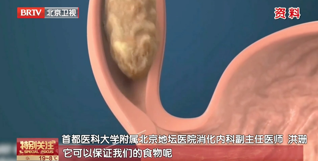 “吃了不烧心”刷屏,可烧的真是心吗?医生:更要紧的是这些报警症状 “吃了不烧心”刷屏,可烧的真是心吗?医生:更要紧的是这些报警症状