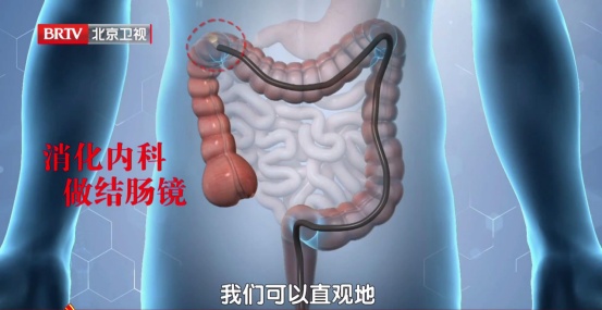 给肠道“减压”的食物，医生建议要多吃，排便又快又干净，还能防便秘