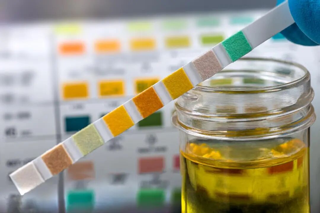 喝水之后总跑厕所和半天不去一次,哪种更伤身体?多数人判断错了 喝水之后总跑厕所和半天不去一次,哪种更伤身体?多数人判断错了