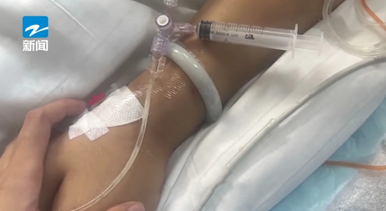 27岁女子感染罕见真菌,不幸去世!和小动物接触有关?医生:感染不等于发病,关键是… 27岁女子感染罕见真菌,不幸去世!和小动物接触有关?医生:感染不等于发病,关键是…