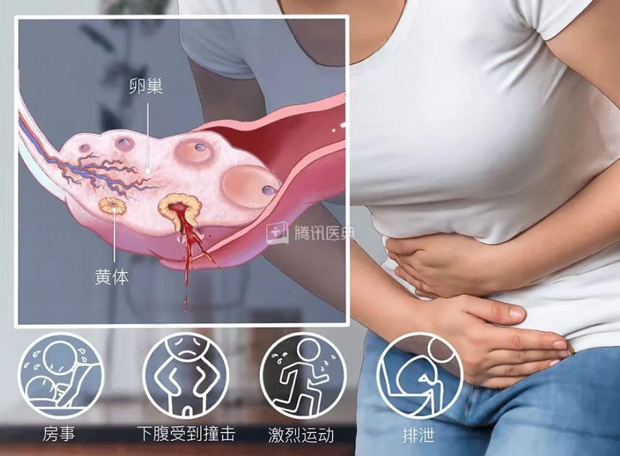 被12斤重的猫踹中腹部,女子紧急送医!医生提醒 被12斤重的猫踹中腹部,女子紧急送医!医生提醒
