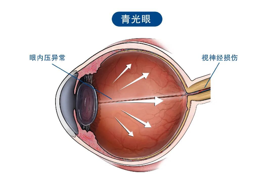睡前刷手机,最怕的不是熬夜,而是它→ 睡前刷手机,最怕的不是熬夜,而是它→