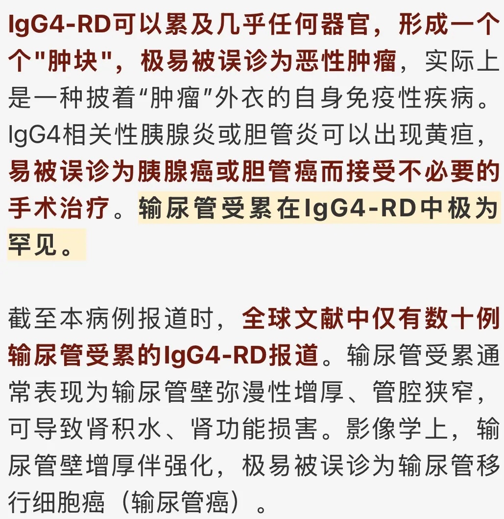 男子全身多处异常肿大!医院:不是癌却像癌,极易被误诊 男子全身多处异常肿大!医院:不是癌却像癌,极易被误诊