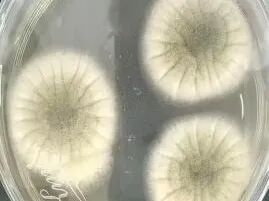 女子煮了存放超2年的核桃,配隔夜剩饭食用,引发重症肝炎合并急性肾衰竭,一度转入ICU 女子煮了存放超2年的核桃,配隔夜剩饭食用,引发重症肝炎合并急性肾衰竭,一度转入ICU