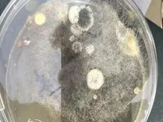 女子煮了存放超2年的核桃,配隔夜剩饭食用,引发重症肝炎合并急性肾衰竭,一度转入ICU 女子煮了存放超2年的核桃,配隔夜剩饭食用,引发重症肝炎合并急性肾衰竭,一度转入ICU