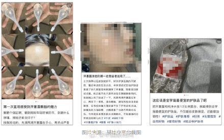 拿开塞露抹脸合适吗?科普中国:不太合适 拿开塞露抹脸合适吗?科普中国:不太合适
