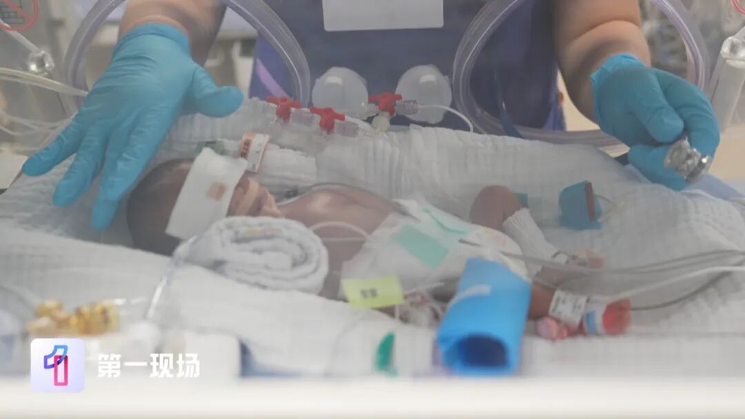 “我舍不得!”二胎妈妈含泪拒绝放弃,530克超早产儿经历重重生死关,终于回家 “我舍不得!”二胎妈妈含泪拒绝放弃,530克超早产儿经历重重生死关,终于回家