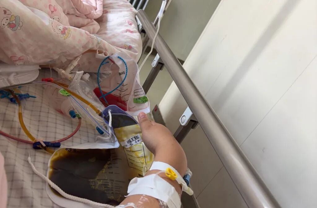 女子为减肥每天只吃1个素包子,7天瘦9斤突发剧痛,确诊急性重症胆囊炎,医生提醒→ 女子为减肥每天只吃1个素包子,7天瘦9斤突发剧痛,确诊急性重症胆囊炎,医生提醒→