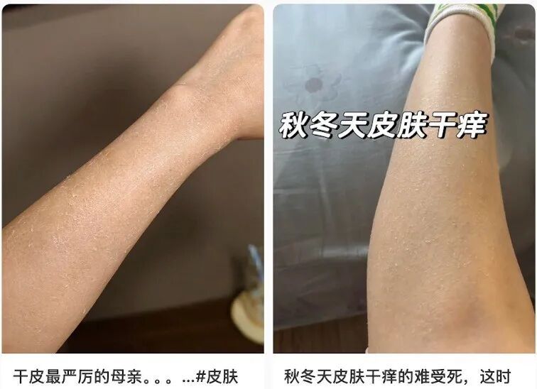 面膜敷得越勤,皮肤越水润?真相来了! 面膜敷得越勤,皮肤越水润?真相来了!