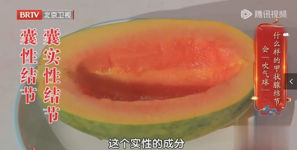 体检查出1厘米结节，半年后确诊癌症，医生痛心：这3个信号就是警报，千万别忽视