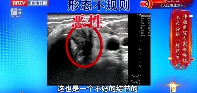 体检查出1厘米结节，半年后确诊癌症，医生痛心：这3个信号就是警报，千万别忽视
