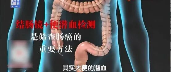 身上有这种“肉”,50岁后几乎100%癌变,有这类“外貌特征”的人风险更大…… 身上有这种“肉”,50岁后几乎100%癌变,有这类“外貌特征”的人风险更大……