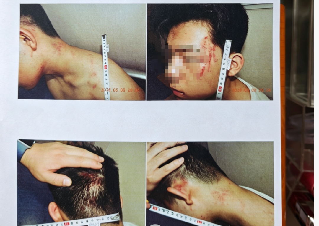 17岁男生遭假警察上门殴打,被强迫跪下磕头、叫爹 17岁男生遭假警察上门殴打,被强迫跪下磕头、叫爹