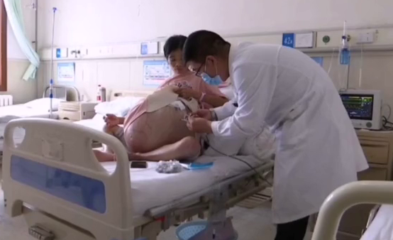 巨肚妈妈手术成功！共从她肚子里取出近80斤肿瘤和腹水