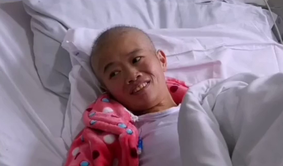 巨肚妈妈手术成功！共从她肚子里取出近80斤肿瘤和腹水