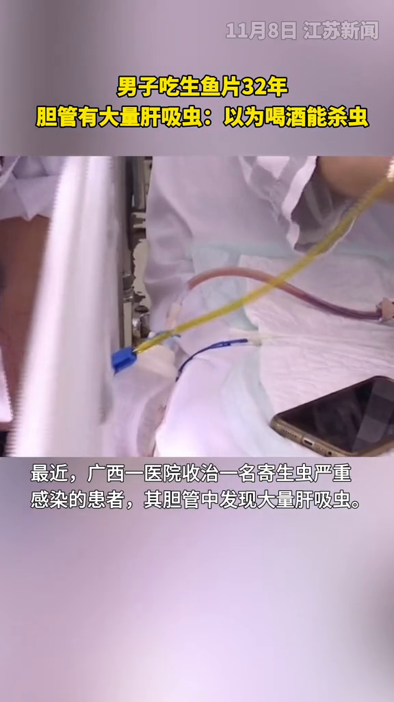 男子吃生鱼片32年,胆管有大量肝吸虫:以为喝酒能杀虫 男子吃生鱼片32年,胆管有大量肝吸虫:以为喝酒能杀虫