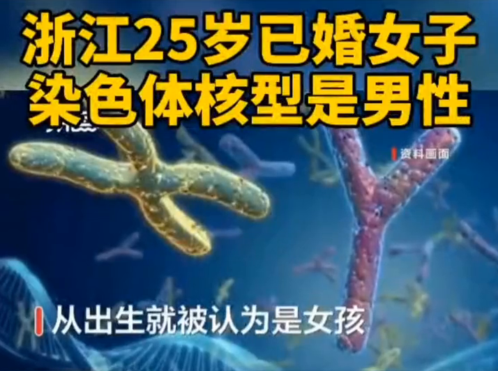 浙江25岁已婚女子染色体核型是男性