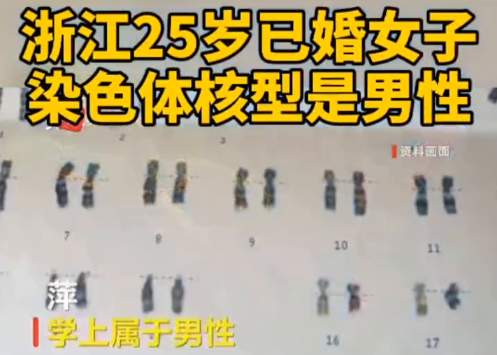 浙江25岁已婚女子染色体核型是男性