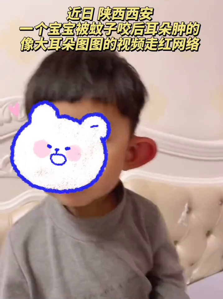萌娃耳朵被蚊子叮成大耳朵图图！妈妈：耳朵大了一倍 厚了一倍！