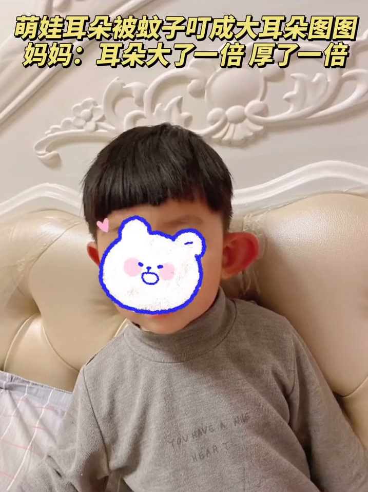 萌娃耳朵被蚊子叮成大耳朵图图！妈妈：耳朵大了一倍 厚了一倍！