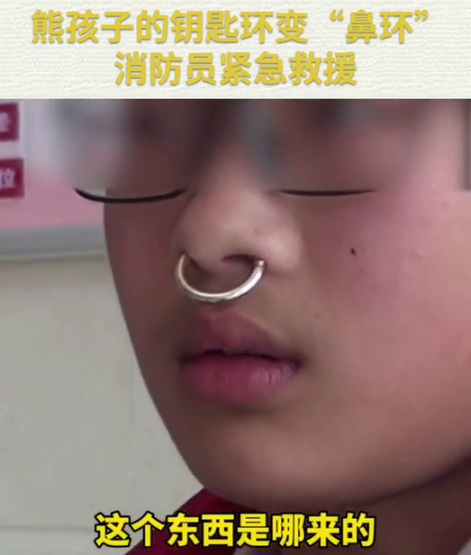 熊孩子把钥匙环变“鼻环”无法摘除，消防员紧急救援
