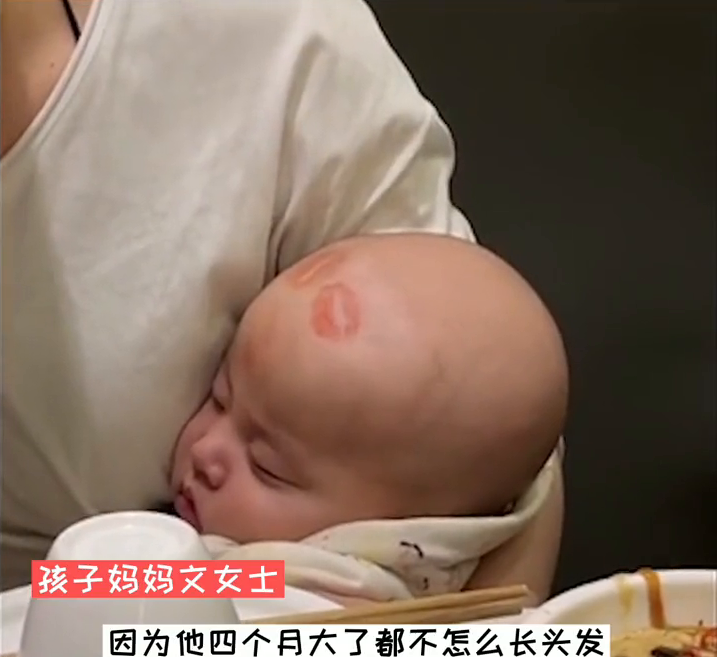 太可爱了！4个月萌娃光头上被妈妈的闺蜜亲了好几个唇印 醒来一脸懵